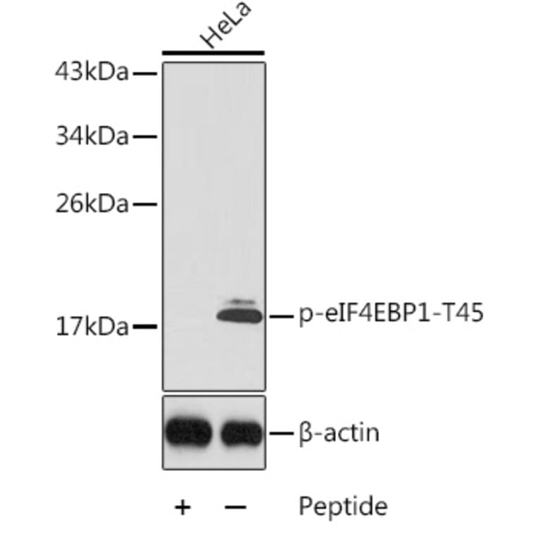 Western Blot - Anti-eIF4EBP1 (phospho Thr45) Antibody (A10899) - Antibodies.com