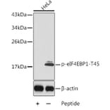 Western Blot - Anti-eIF4EBP1 (phospho Thr45) Antibody (A10899) - Antibodies.com