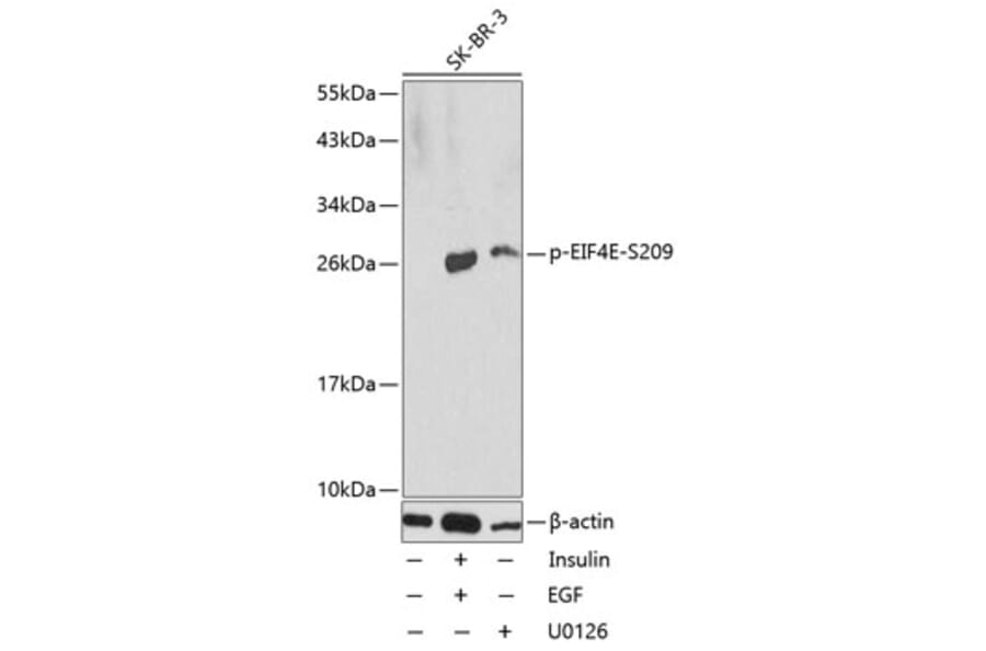Western Blot - Anti-EIF4E (phospho S209) Antibody (AP0228) - Antibodies.com