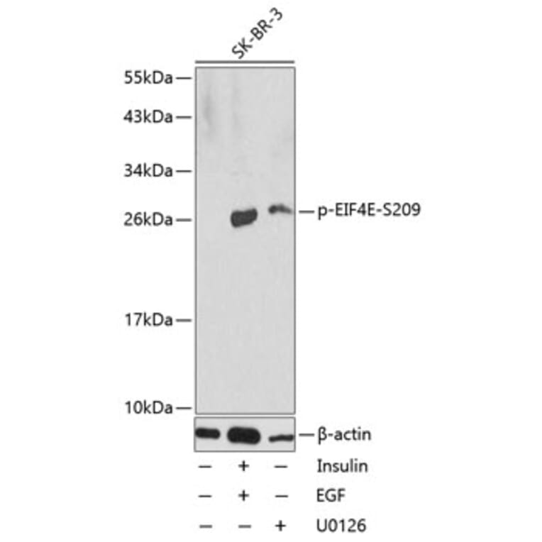 Western Blot - Anti-EIF4E (phospho S209) Antibody (AP0228) - Antibodies.com
