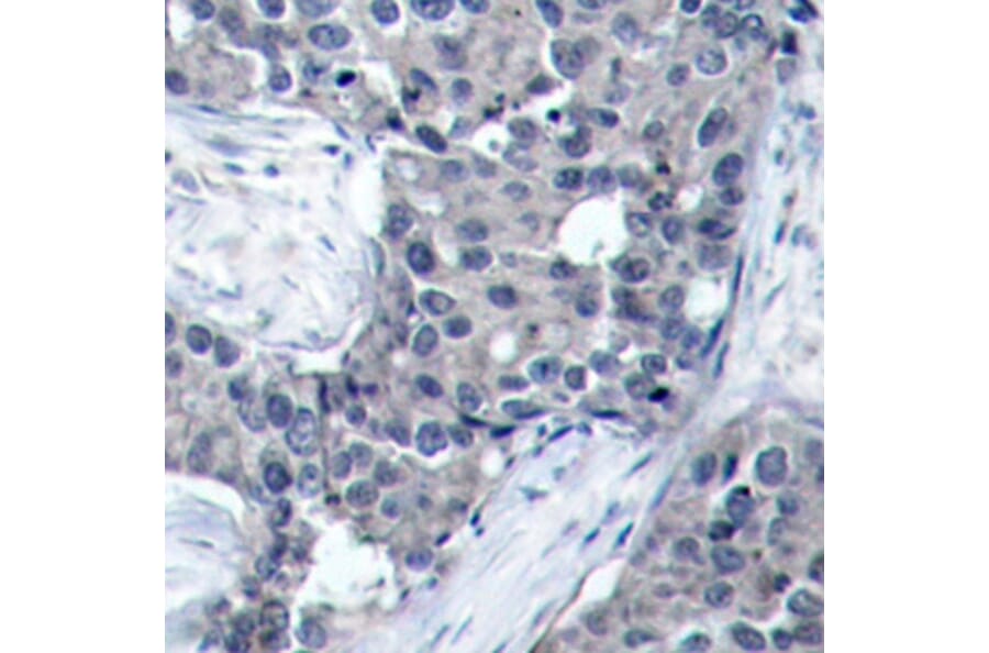 Immunohistochemistry - Anti-EIF4E (phospho S209) Antibody (AP0228) - Antibodies.com