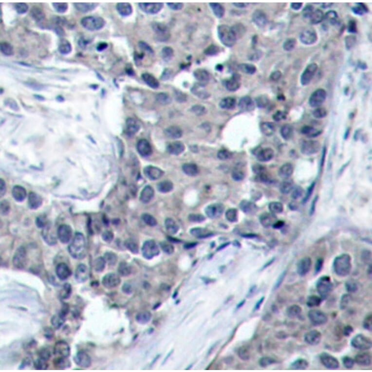 Immunohistochemistry - Anti-EIF4E (phospho S209) Antibody (AP0228) - Antibodies.com
