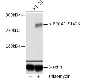 Western Blot - Anti-BRCA1 (phospho Ser1423) Antibody (A10901) - Antibodies.com