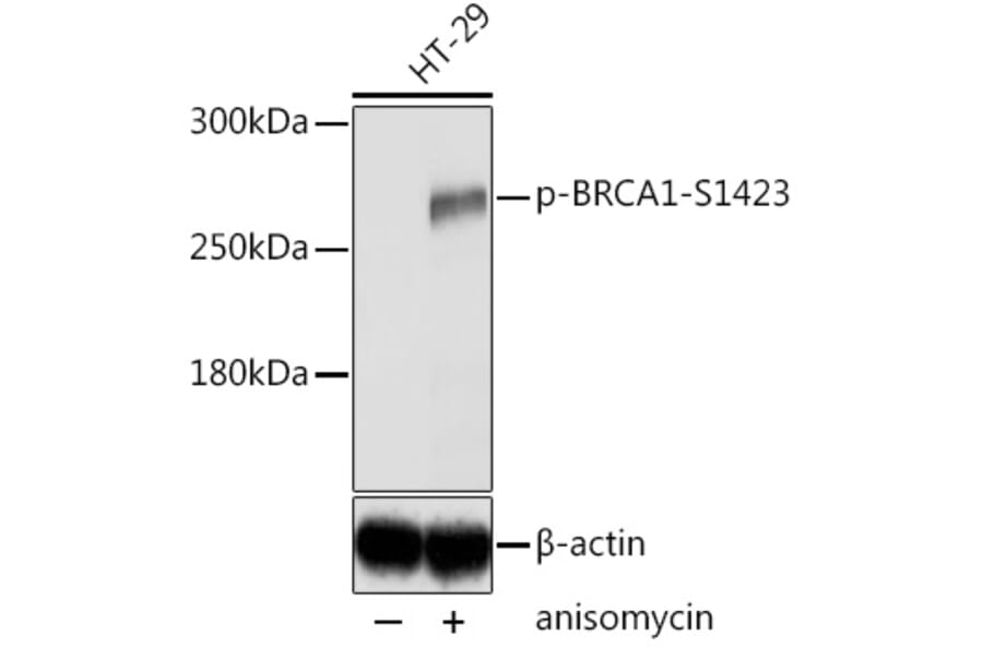 Western Blot - Anti-BRCA1 (phospho Ser1423) Antibody (A10901) - Antibodies.com