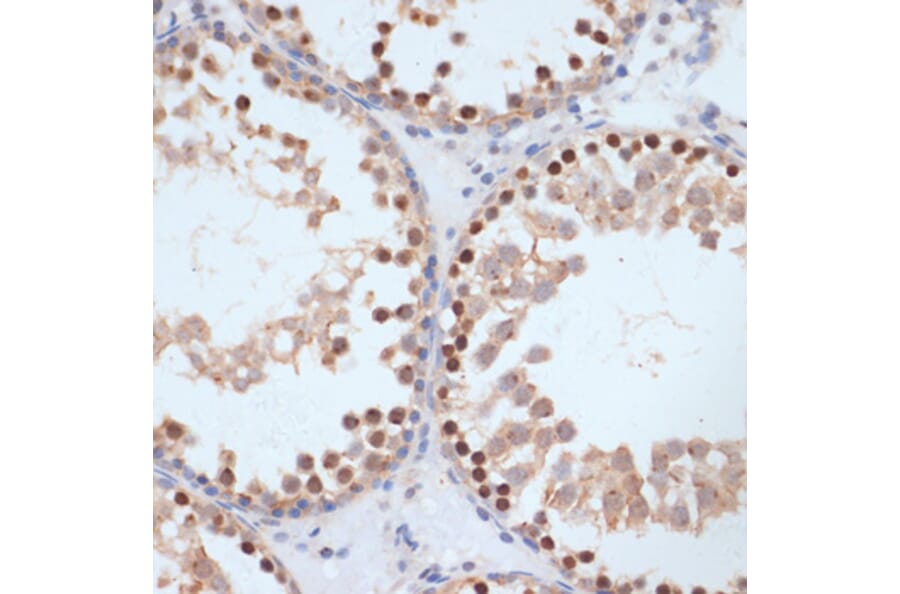 Immunohistochemistry - Anti-BRCA1 (phospho Ser1423) Antibody (A10901) - Antibodies.com