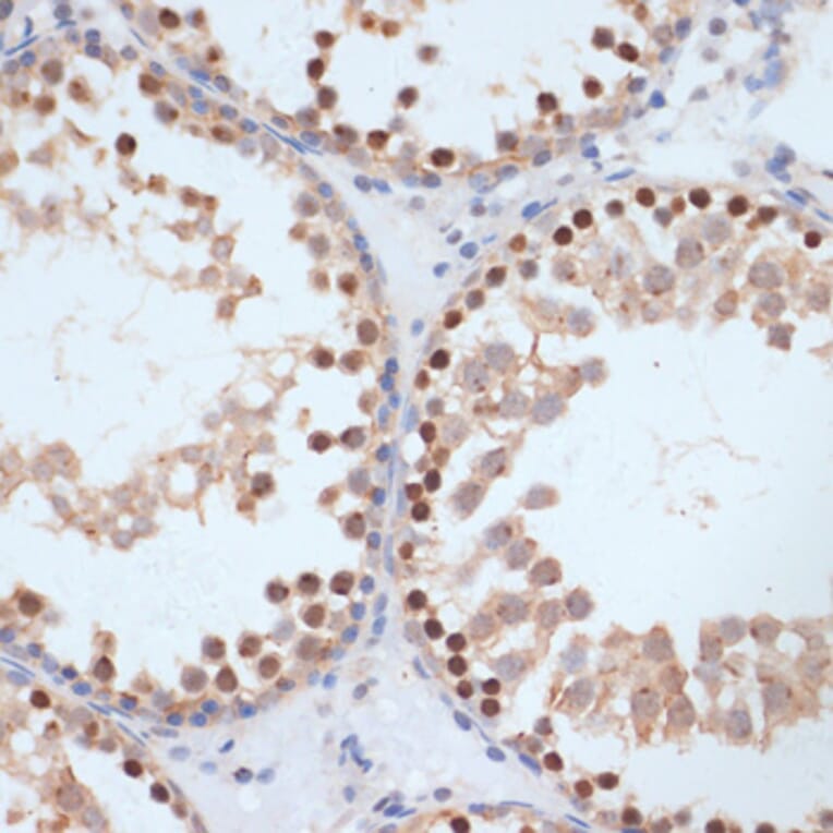 Immunohistochemistry - Anti-BRCA1 (phospho Ser1423) Antibody (A10901) - Antibodies.com