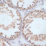 Immunohistochemistry - Anti-BRCA1 (phospho Ser1423) Antibody (A10901) - Antibodies.com