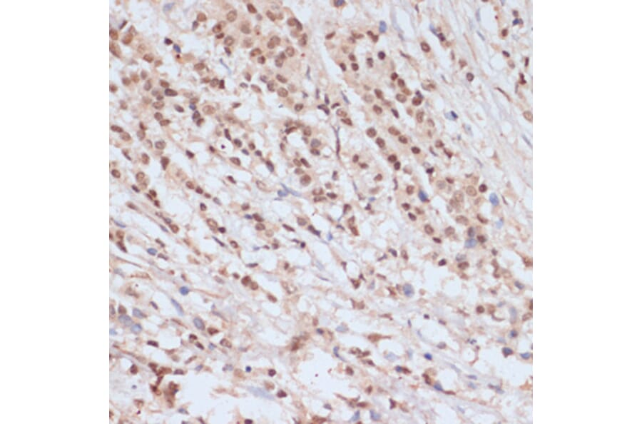 Immunohistochemistry - Anti-BRCA1 (phospho Ser1423) Antibody (A10901) - Antibodies.com