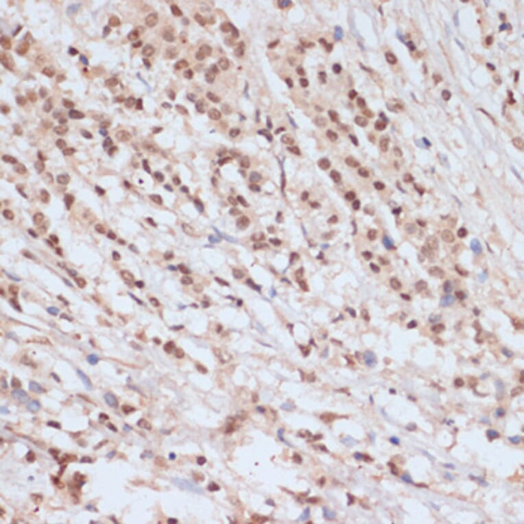 Immunohistochemistry - Anti-BRCA1 (phospho Ser1423) Antibody (A10901) - Antibodies.com