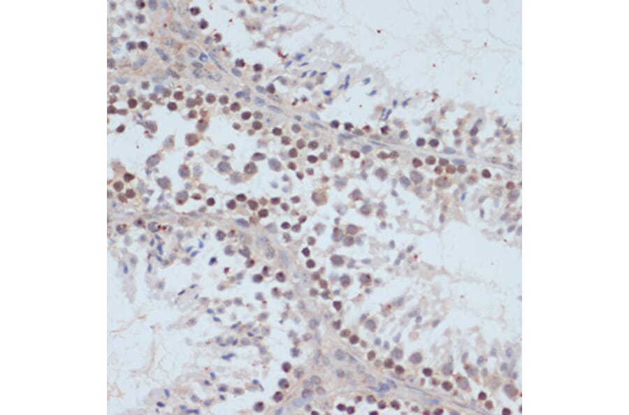 Immunohistochemistry - Anti-BRCA1 (phospho Ser1423) Antibody (A10901) - Antibodies.com