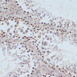 Immunohistochemistry - Anti-BRCA1 (phospho Ser1423) Antibody (A10901) - Antibodies.com