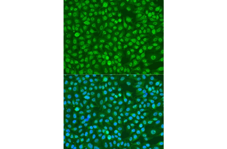 Immunofluorescence - Anti-BRCA1 (phospho Ser1423) Antibody (A10901) - Antibodies.com