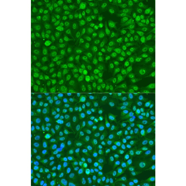 Immunofluorescence - Anti-BRCA1 (phospho Ser1423) Antibody (A10901) - Antibodies.com