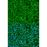 Immunofluorescence - Anti-BRCA1 (phospho Ser1423) Antibody (A10901) - Antibodies.com