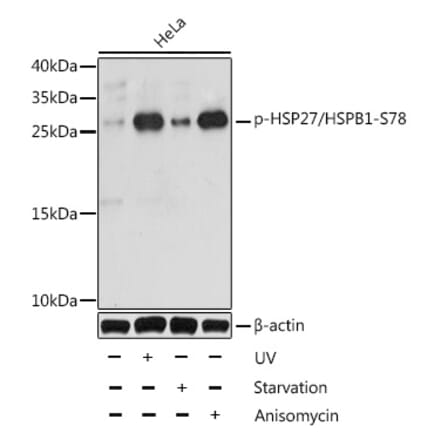 Western Blot - Anti-Hsp27 (phospho Ser78) Antibody (A10902) - Antibodies.com