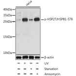 Western Blot - Anti-Hsp27 (phospho Ser78) Antibody (A10902) - Antibodies.com