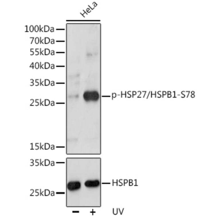 Western Blot - Anti-Hsp27 (phospho Ser78) Antibody (A10902) - Antibodies.com