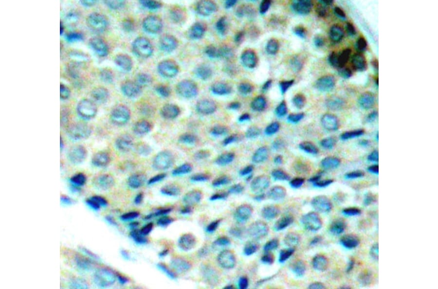 Immunohistochemistry - Anti-Hsp27 (phospho Ser78) Antibody (A10902) - Antibodies.com