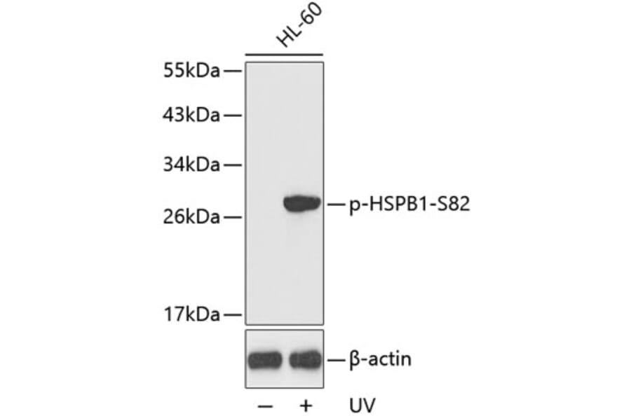 Western Blot - Anti-HSPB1 (phospho S82) Antibody (AP0237) - Antibodies.com