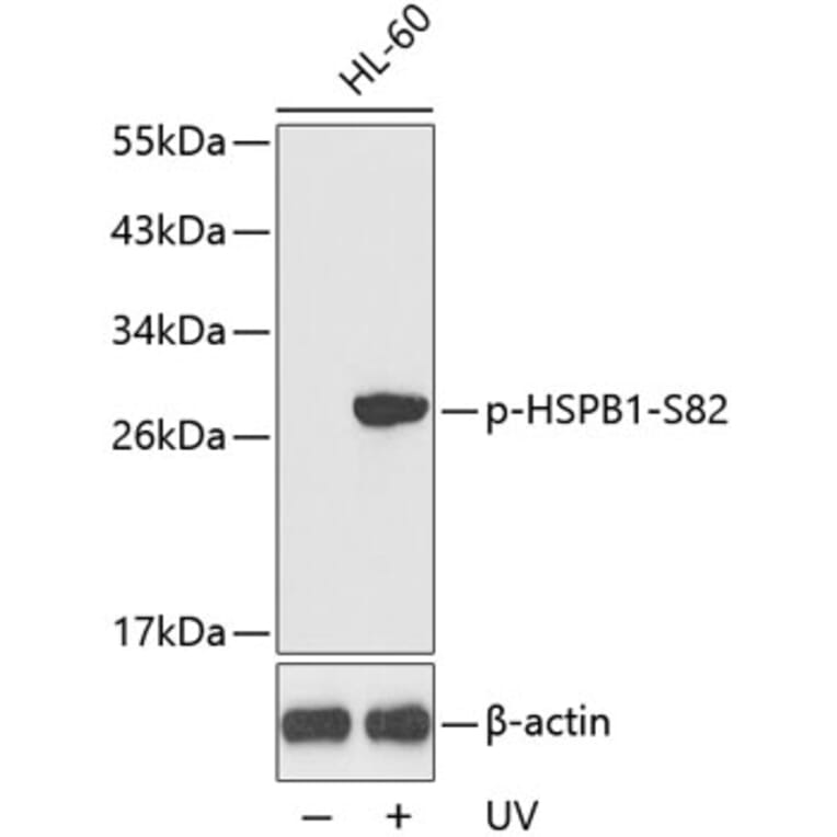 Western Blot - Anti-HSPB1 (phospho S82) Antibody (AP0237) - Antibodies.com