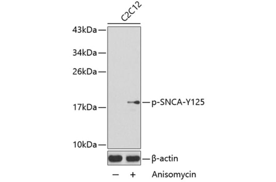 Western Blot - Anti-SNCA (phospho Y125) Antibody (AP0241) - Antibodies.com