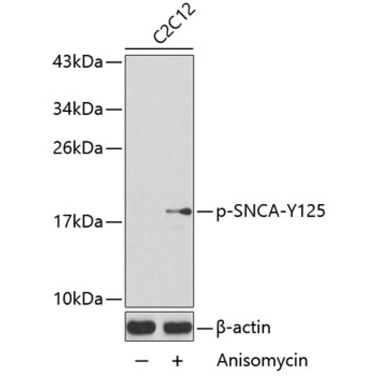 Western Blot - Anti-SNCA (phospho Y125) Antibody (AP0241) - Antibodies.com