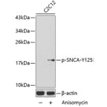 Western Blot - Anti-SNCA (phospho Y125) Antibody (AP0241) - Antibodies.com