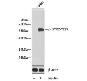 Western Blot - Anti-DOK2 (phospho Tyr299) Antibody (A10905) - Antibodies.com