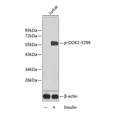 Western Blot - Anti-DOK2 (phospho Tyr299) Antibody (A10905) - Antibodies.com