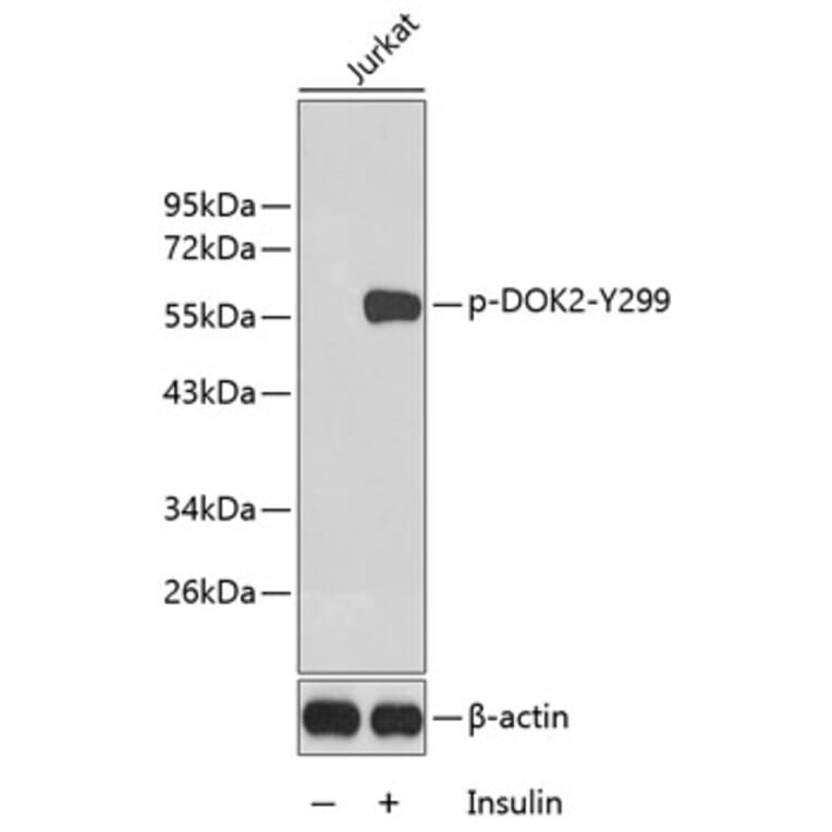 Western Blot - Anti-DOK2 (phospho Tyr299) Antibody (A10905) - Antibodies.com