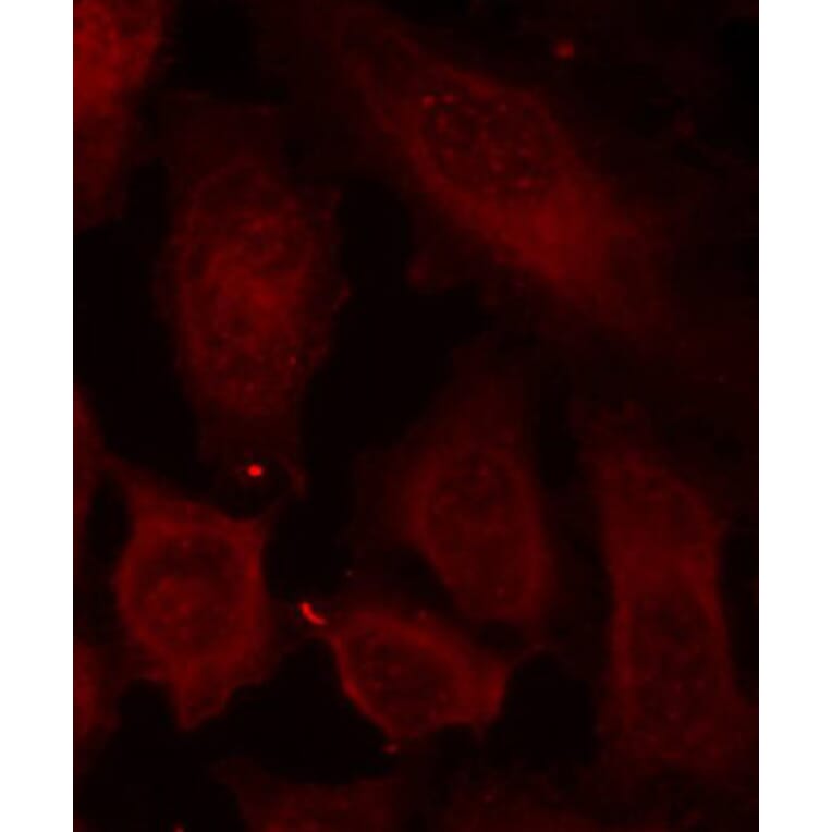 Immunofluorescence - Anti-DOK2 (phospho Tyr299) Antibody (A10905) - Antibodies.com