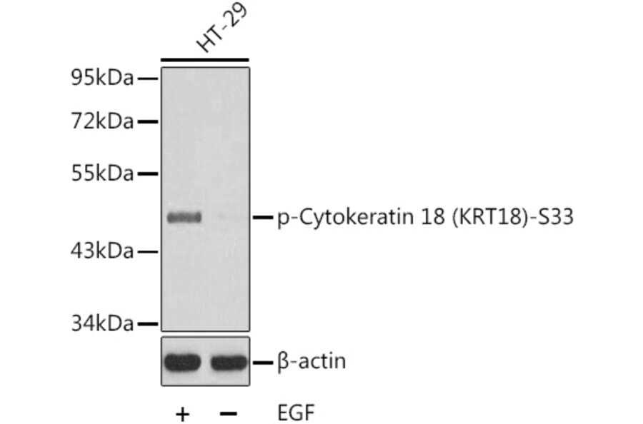 Western Blot - Anti-Cytokeratin 18 (phospho Ser33) Antibody (A10906) - Antibodies.com