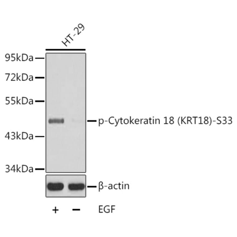 Western Blot - Anti-Cytokeratin 18 (phospho Ser33) Antibody (A10906) - Antibodies.com