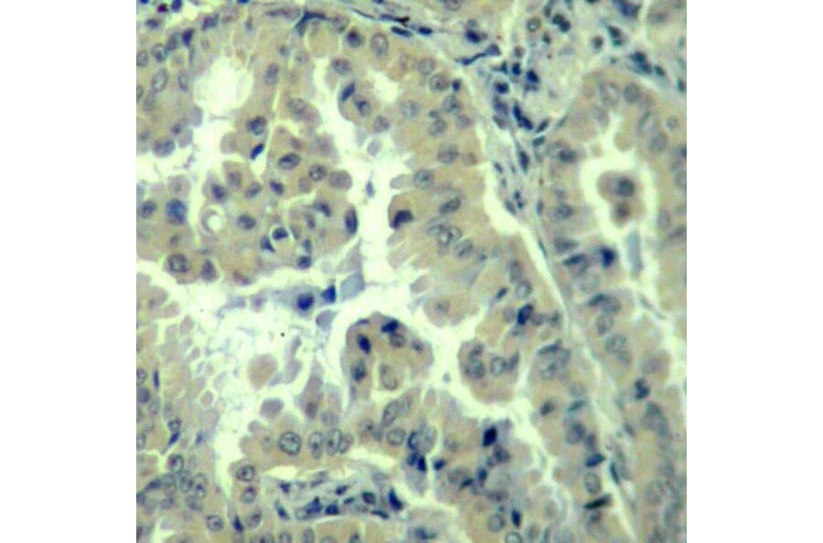 Immunohistochemistry - Anti-EIF4G1 (phospho S1232) Antibody (AP0279) - Antibodies.com