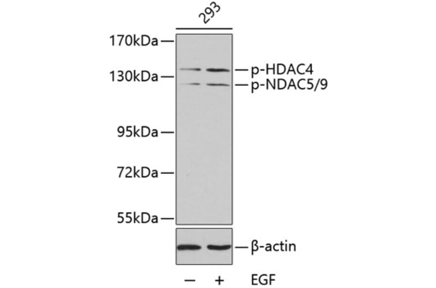 Western Blot - Anti-HDAC4 (phospho Ser246) + HDAC5 (phospho Ser259) + HDAC9 (phospho Ser220) Antibody (A10908) - Antibodies.com