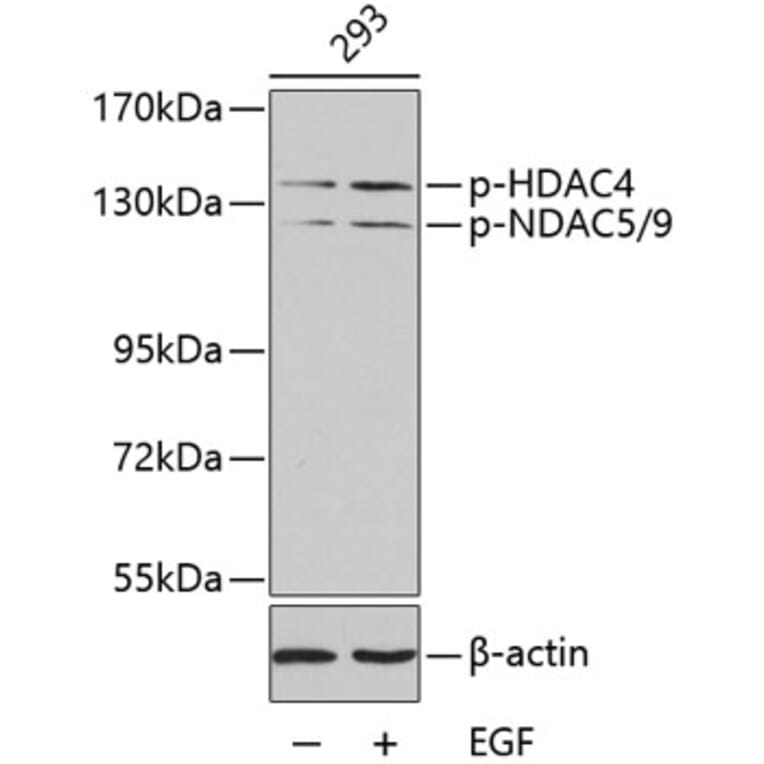Western Blot - Anti-HDAC4 (phospho Ser246) + HDAC5 (phospho Ser259) + HDAC9 (phospho Ser220) Antibody (A10908) - Antibodies.com