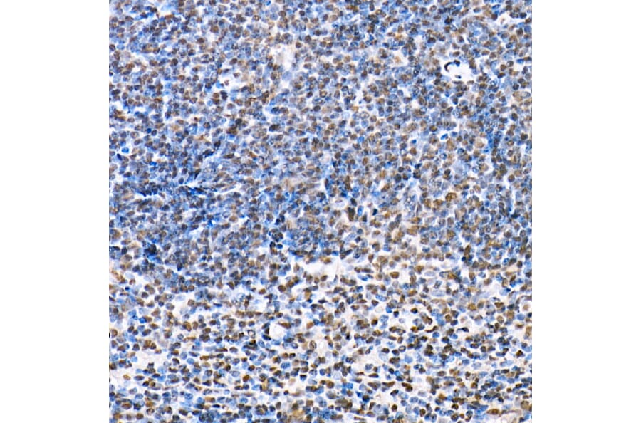 Immunohistochemistry - Anti-HDAC4 (phospho Ser246) + HDAC5 (phospho Ser259) + HDAC9 (phospho Ser220) Antibody (A10908) - Antibodies.com