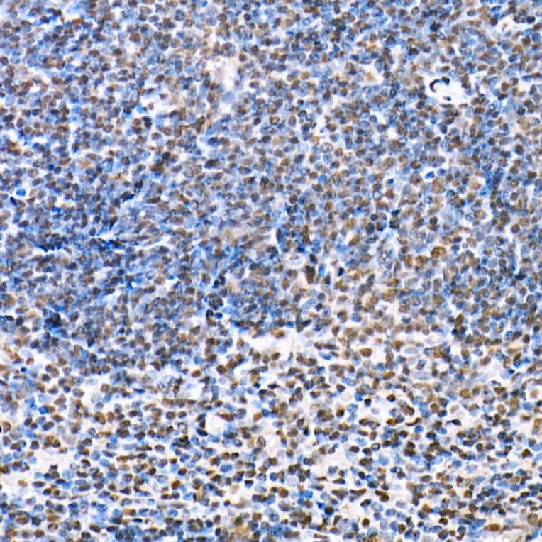Immunohistochemistry - Anti-HDAC4 (phospho Ser246) + HDAC5 (phospho Ser259) + HDAC9 (phospho Ser220) Antibody (A10908) - Antibodies.com