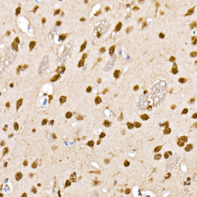 Immunohistochemistry - Anti-HDAC4 (phospho Ser246) + HDAC5 (phospho Ser259) + HDAC9 (phospho Ser220) Antibody (A10908) - Antibodies.com