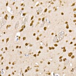 Immunohistochemistry - Anti-HDAC4 (phospho Ser246) + HDAC5 (phospho Ser259) + HDAC9 (phospho Ser220) Antibody (A10908) - Antibodies.com