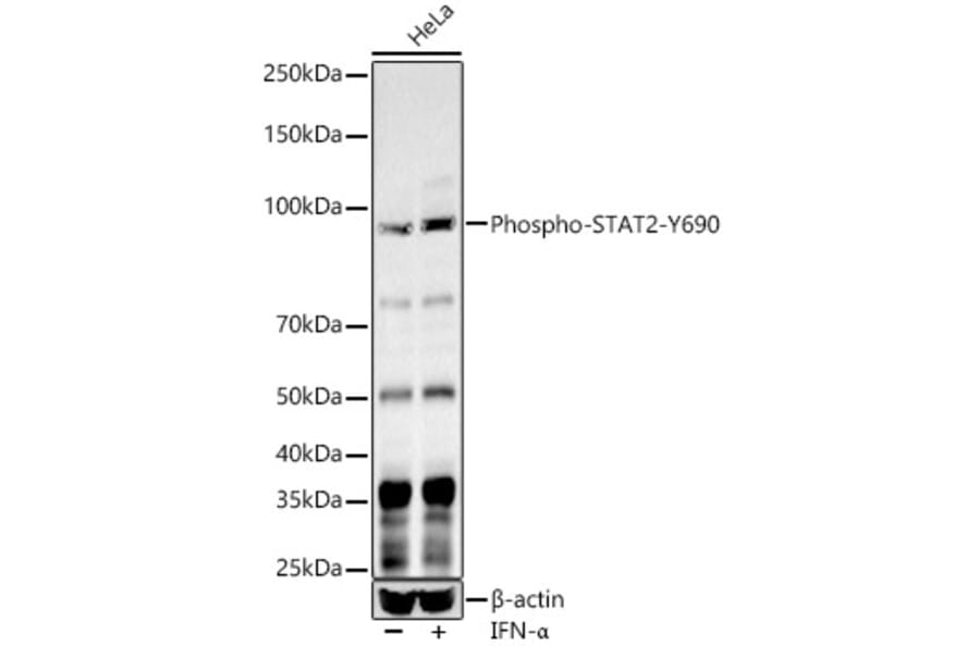 Western Blot - Anti-STAT2 (Phospho Y690) Antibody (A10909) - Antibodies.com