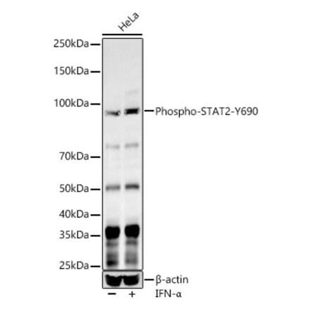 Western Blot - Anti-STAT2 (Phospho Y690) Antibody (A10909) - Antibodies.com