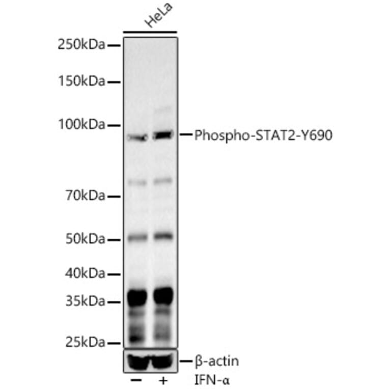 Western Blot - Anti-STAT2 (Phospho Y690) Antibody (A10909) - Antibodies.com