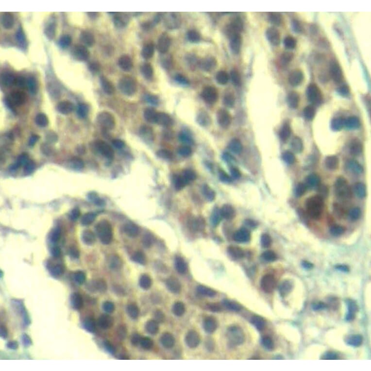 Immunohistochemistry - Anti-CCNB1 (phospho S147) Antibody (AP0287) - Antibodies.com