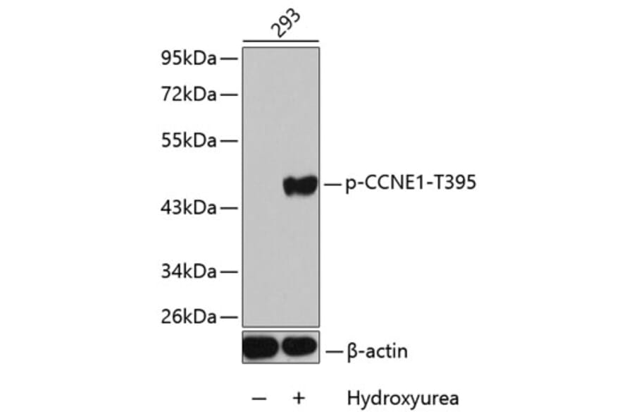 Western Blot - Anti-CCNE1 (phospho T395) Antibody (AP0288) - Antibodies.com