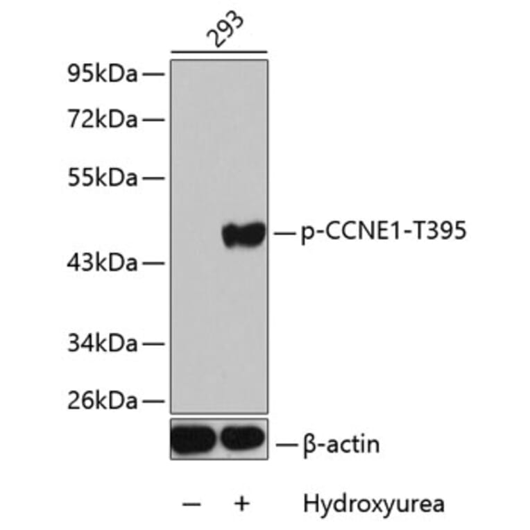 Western Blot - Anti-CCNE1 (phospho T395) Antibody (AP0288) - Antibodies.com