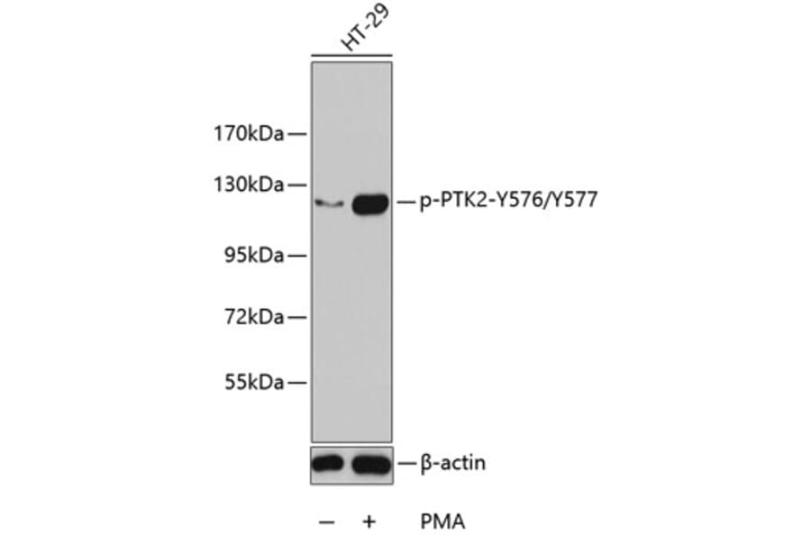 Western Blot - Anti-PTK2 (phospho Y576 + Y577) Antibody (AP0290) - Antibodies.com