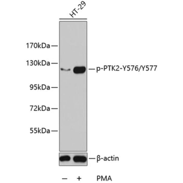 Western Blot - Anti-PTK2 (phospho Y576 + Y577) Antibody (AP0290) - Antibodies.com