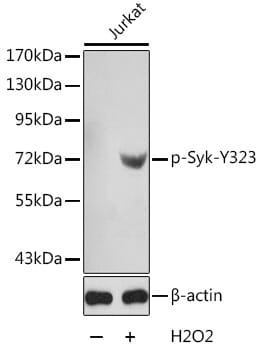 Anti-Syk Antibody [SYK-01] (A85858) | Antibodies.com