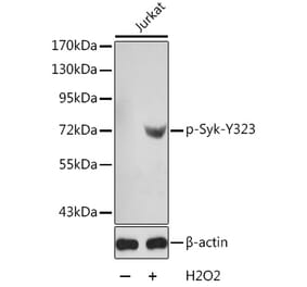Western Blot - Anti-Syk (phospho Tyr323) Antibody (A10913) - Antibodies.com